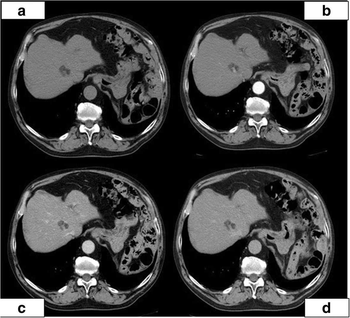 Fig. 1