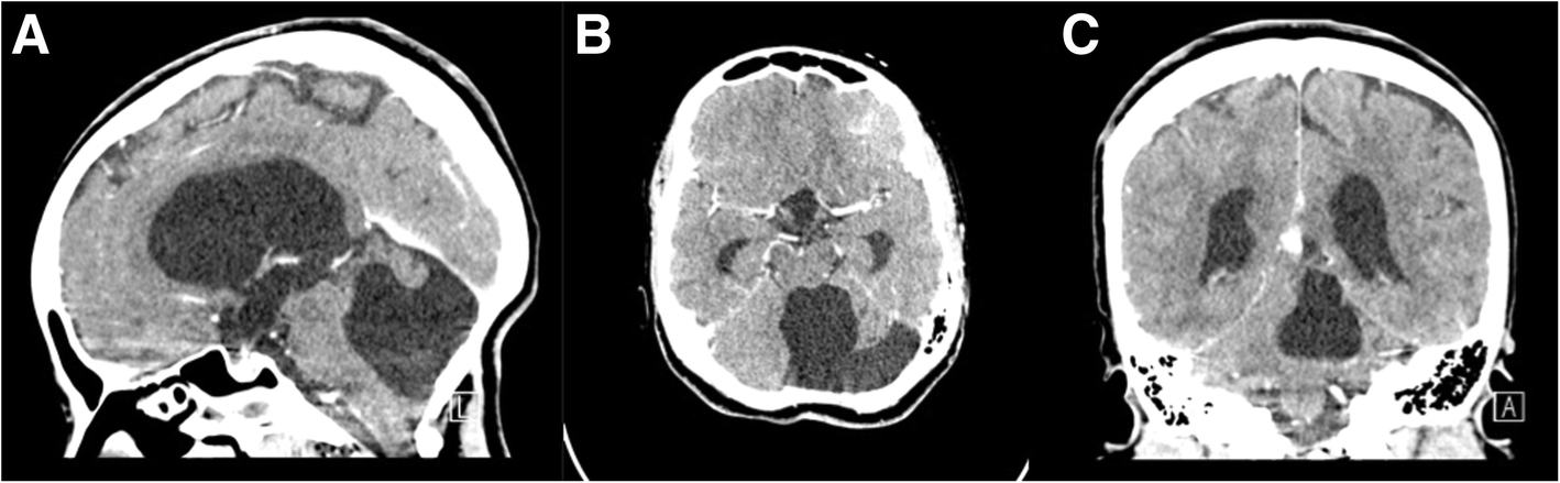 Fig. 5