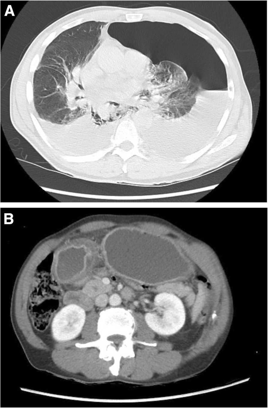 Fig. 1