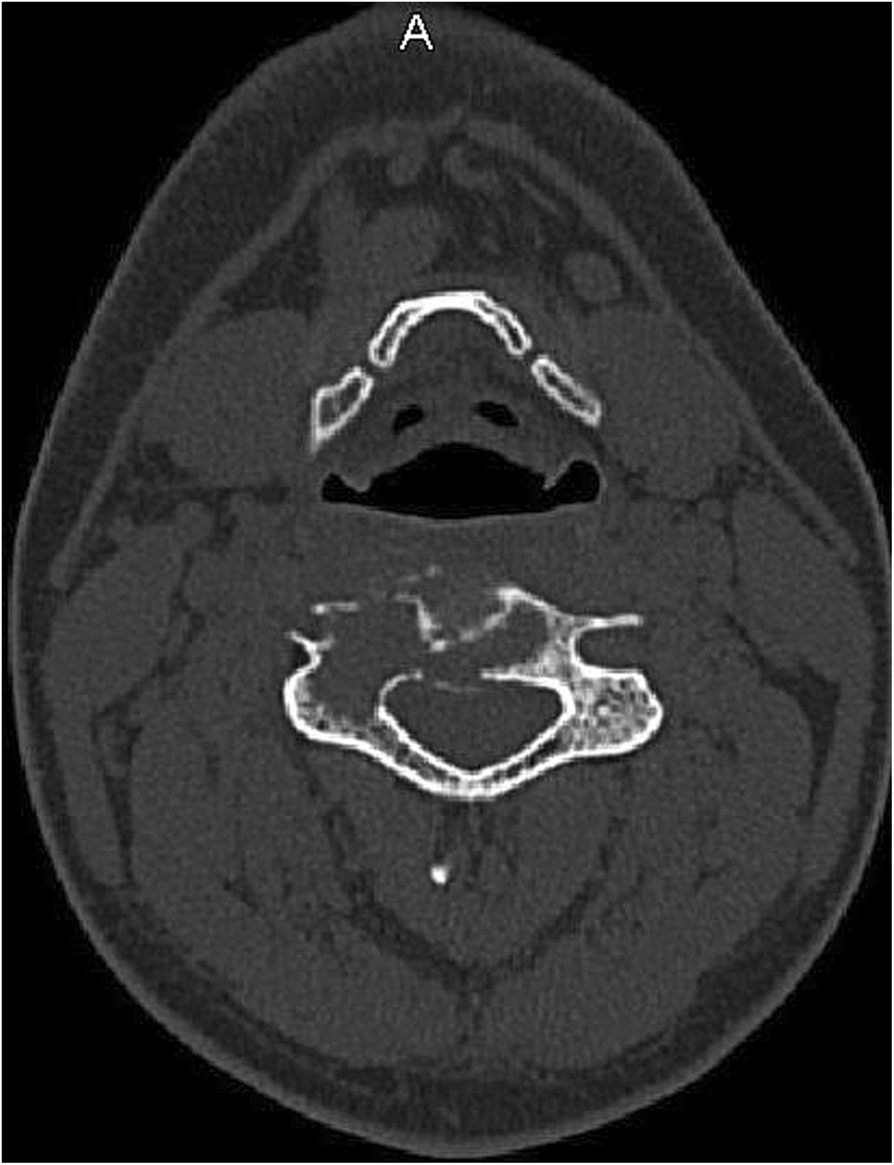 Fig. 2