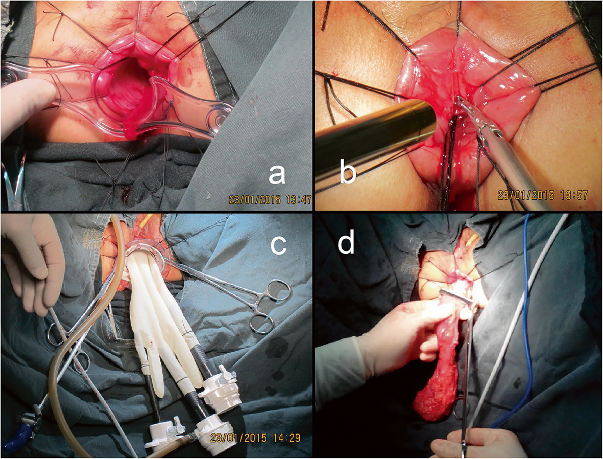 Fig. 1