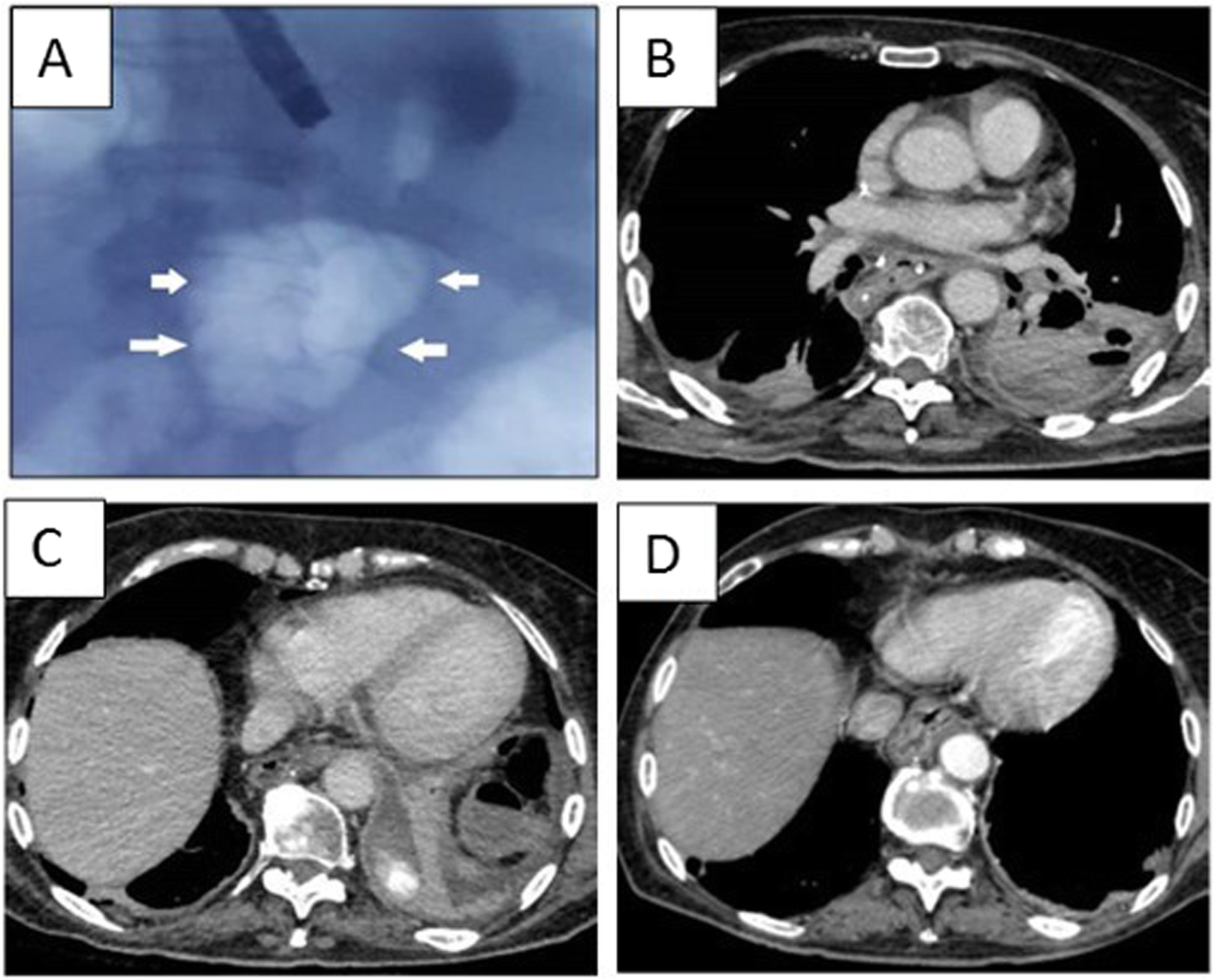 Fig. 2