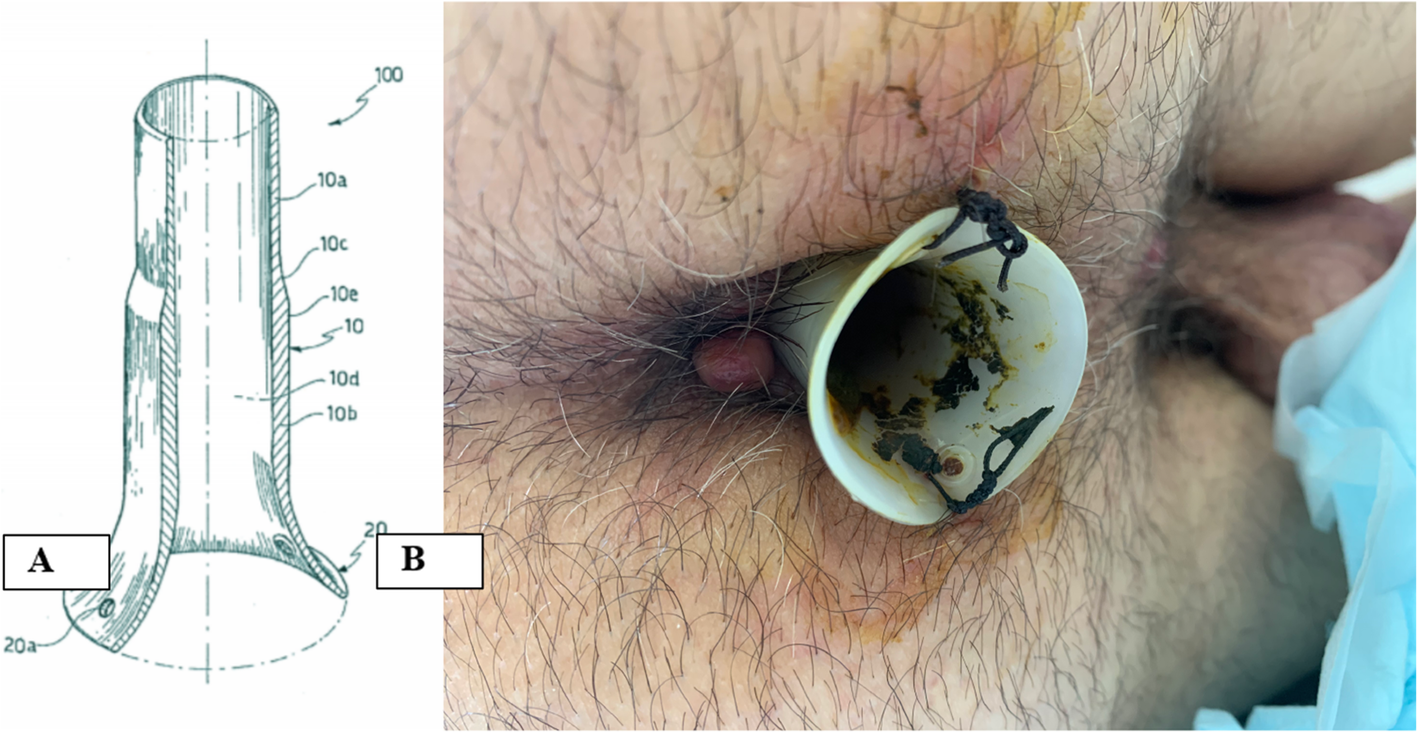 Fig. 1