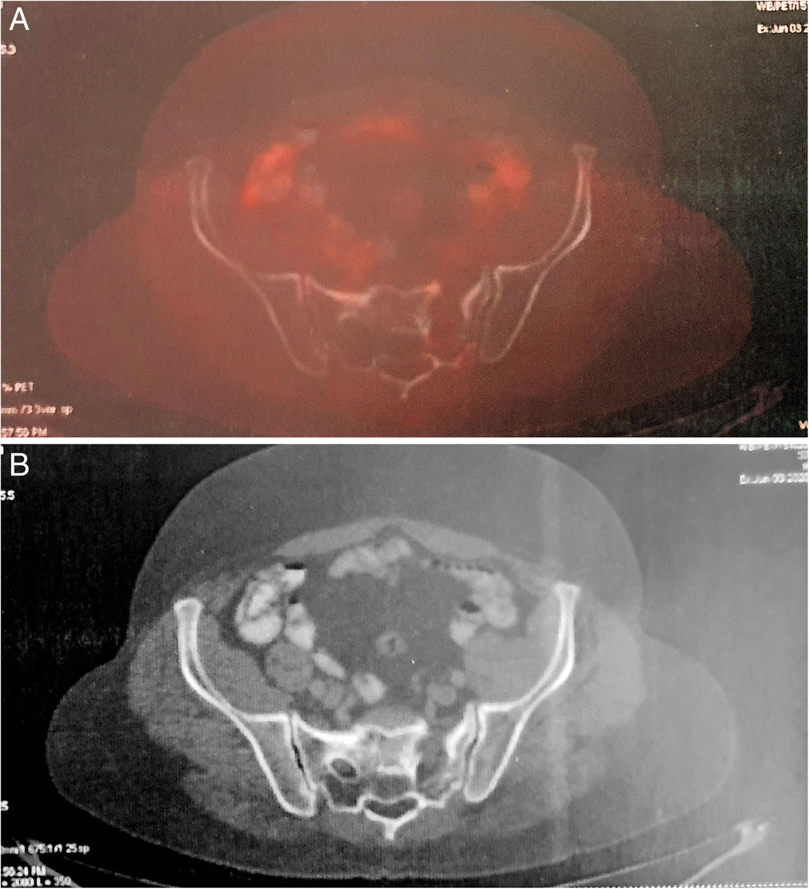 Fig. 7