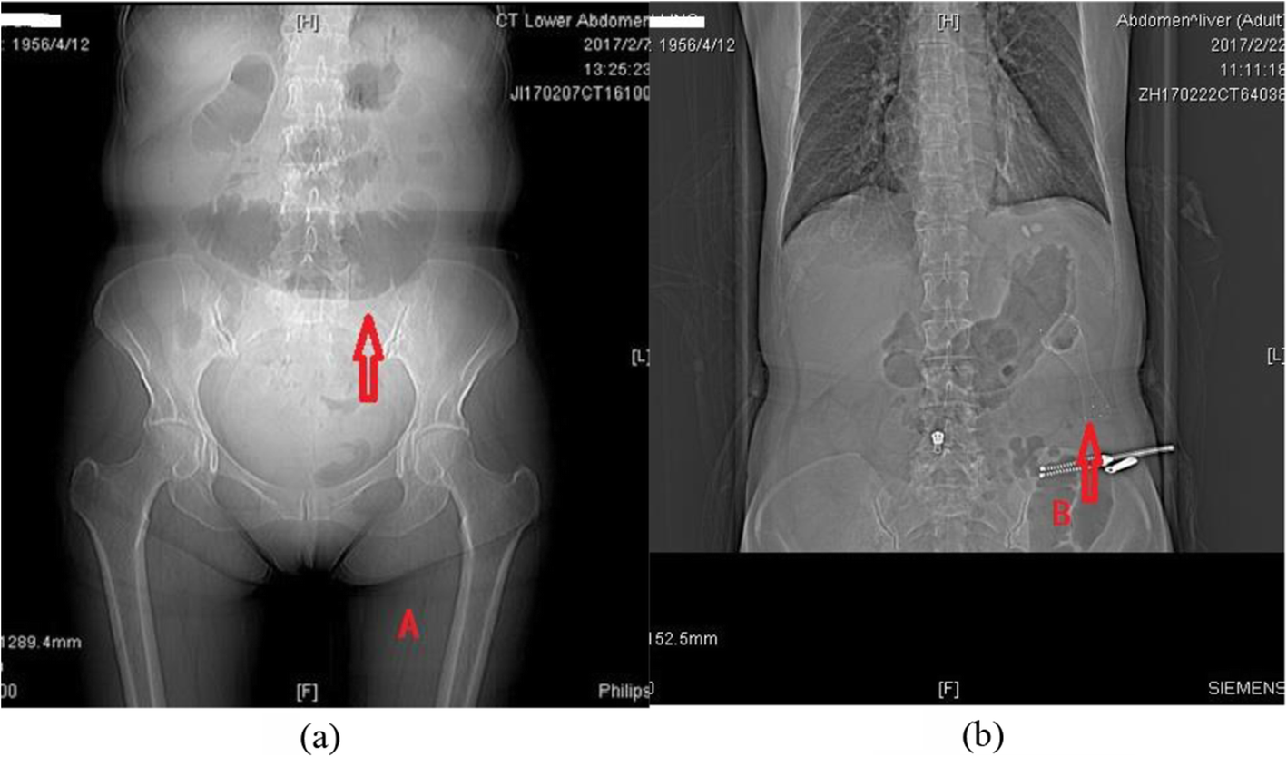 Fig. 3