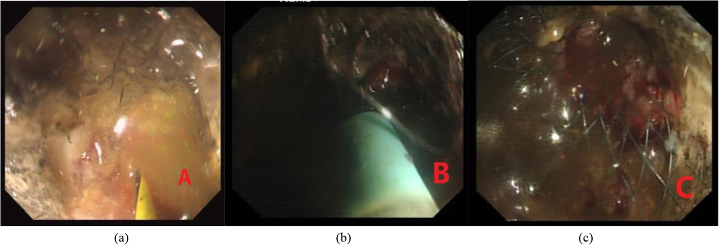 Fig. 6