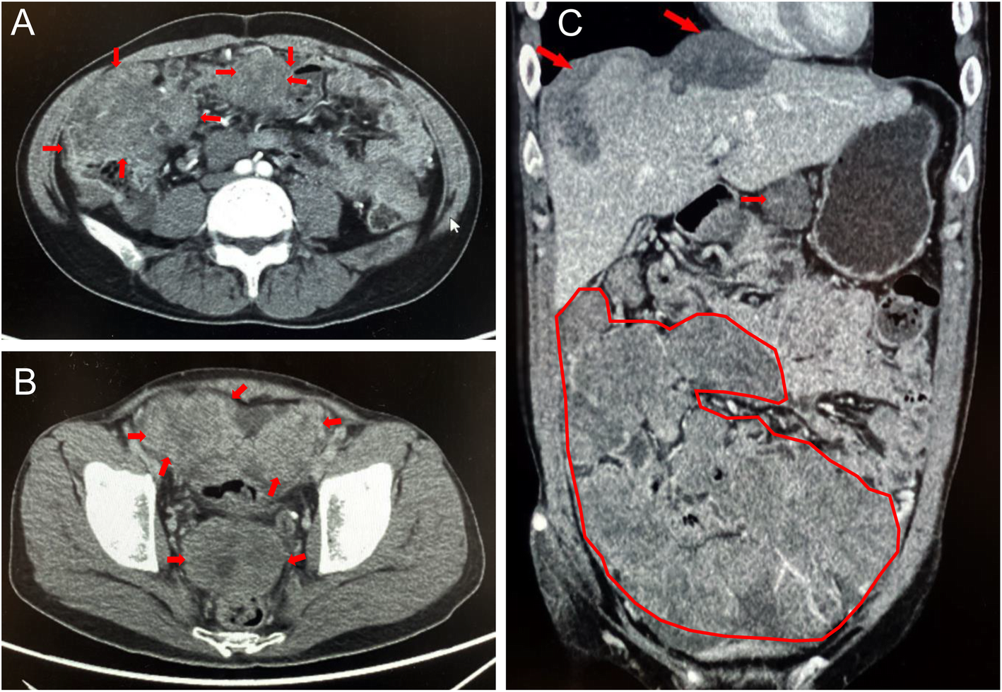 Fig. 2