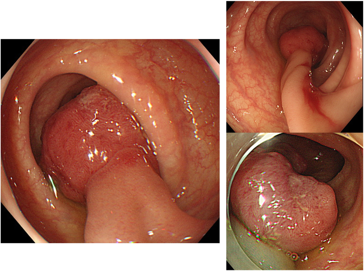 Fig. 1