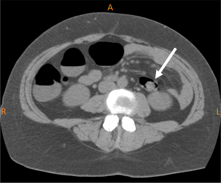 Fig. 2