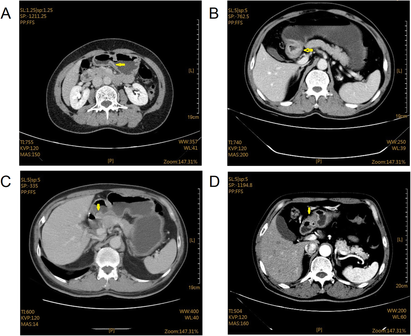 Fig. 4