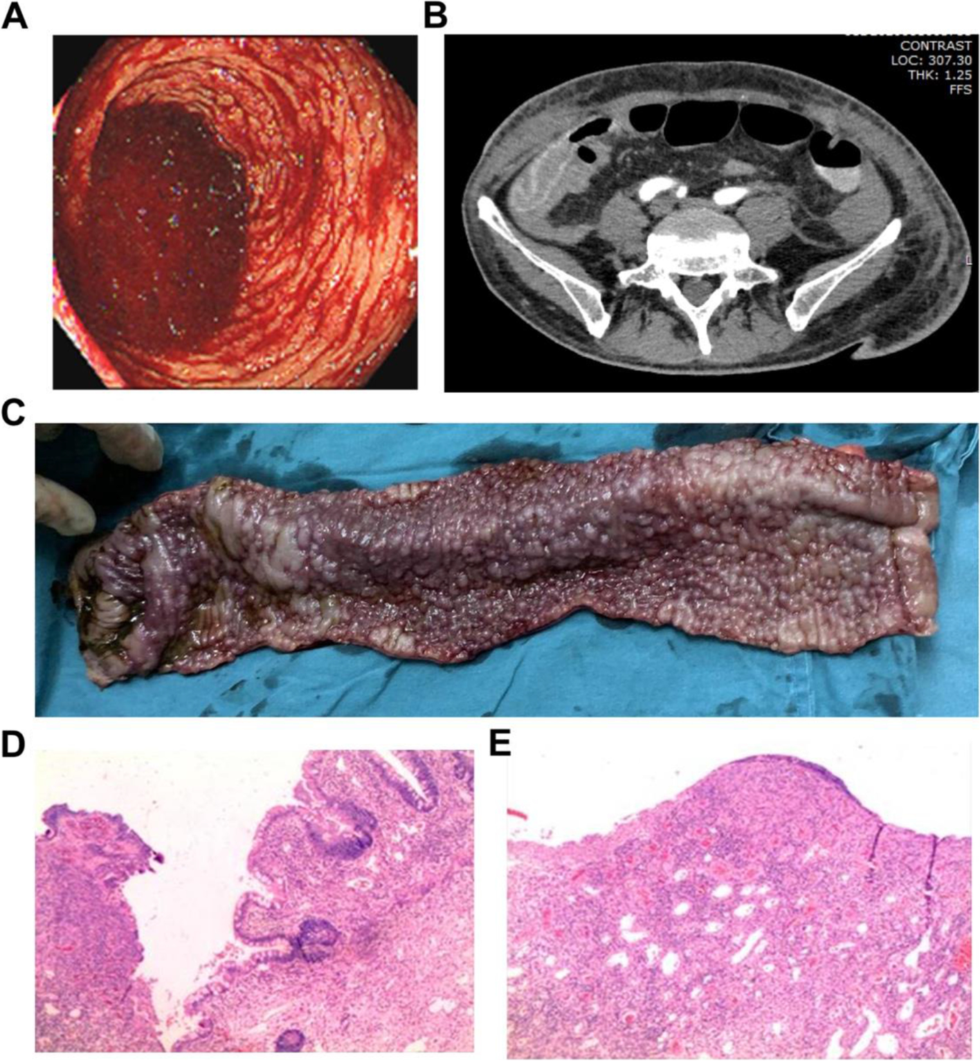 Fig. 1