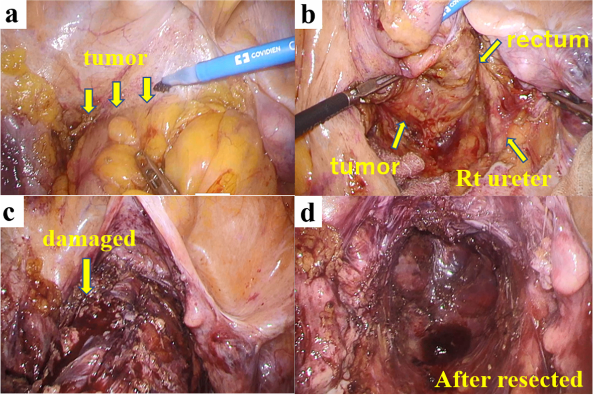 Fig. 4