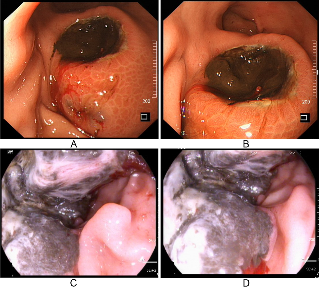 Fig. 2