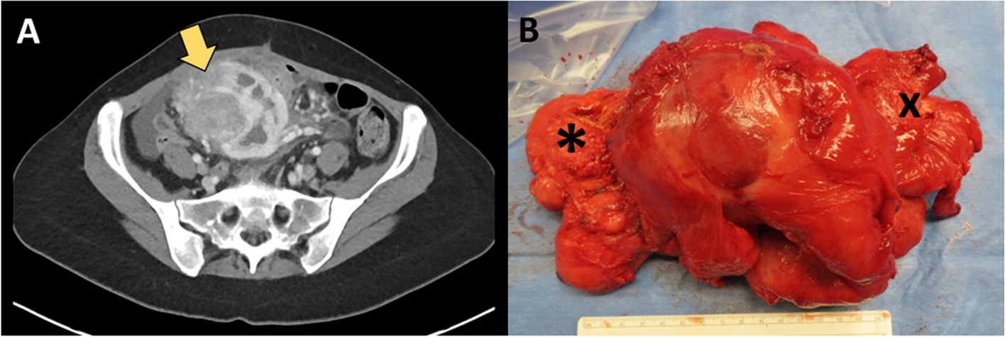 Fig. 1