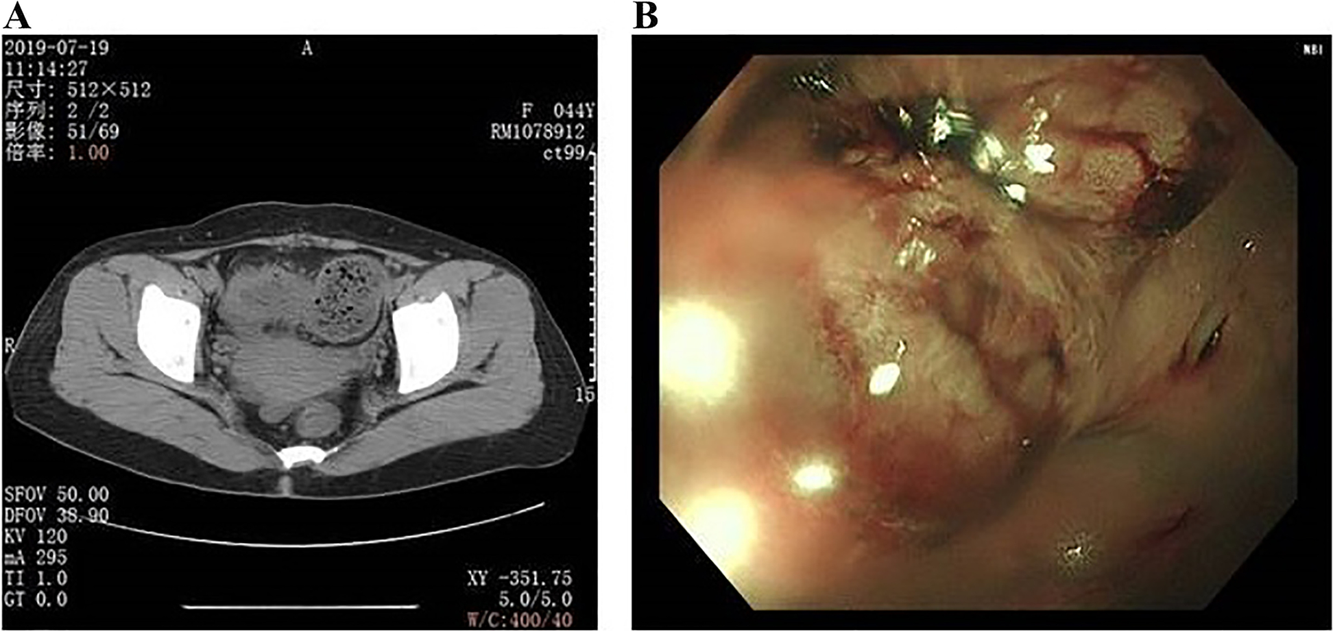 Fig. 1