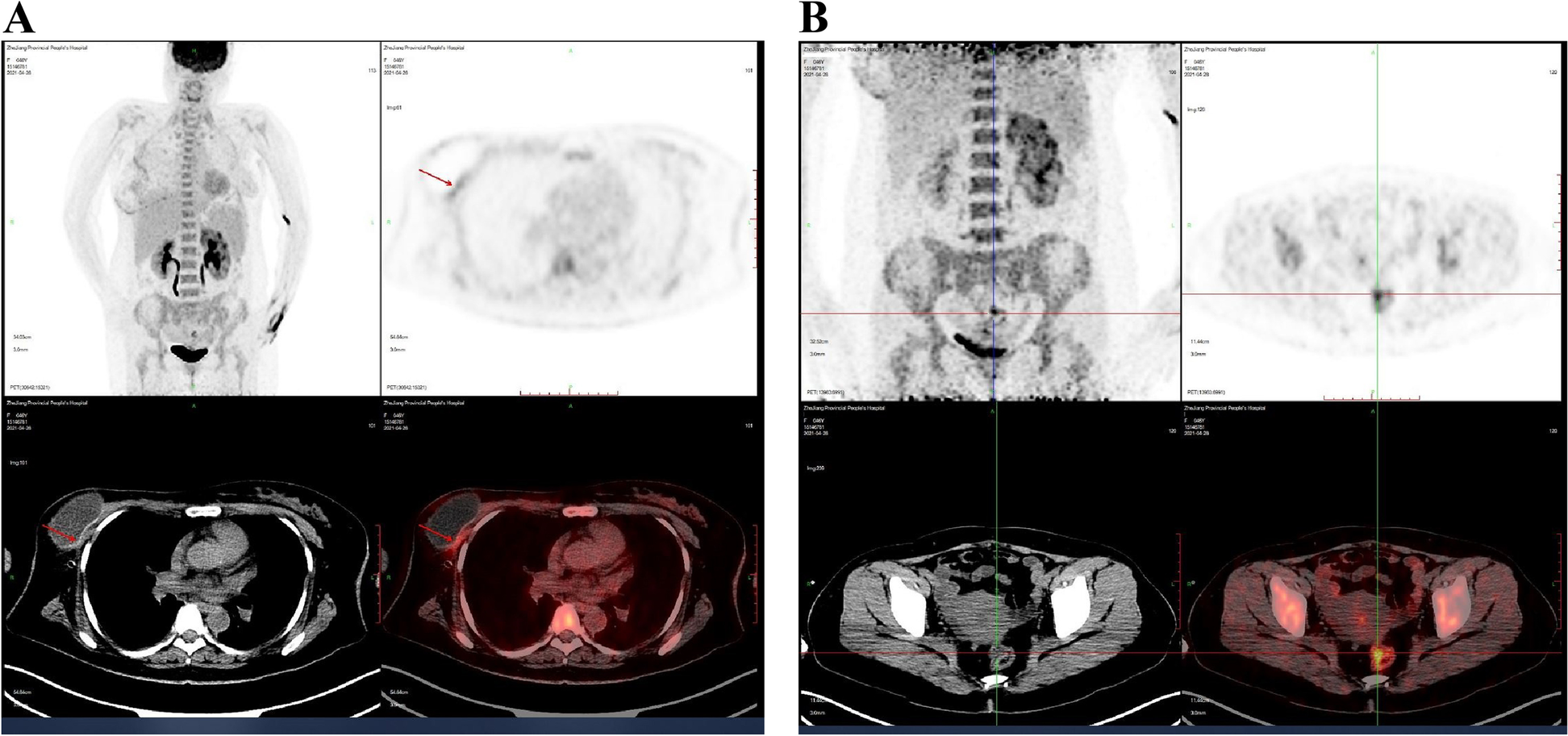 Fig. 4