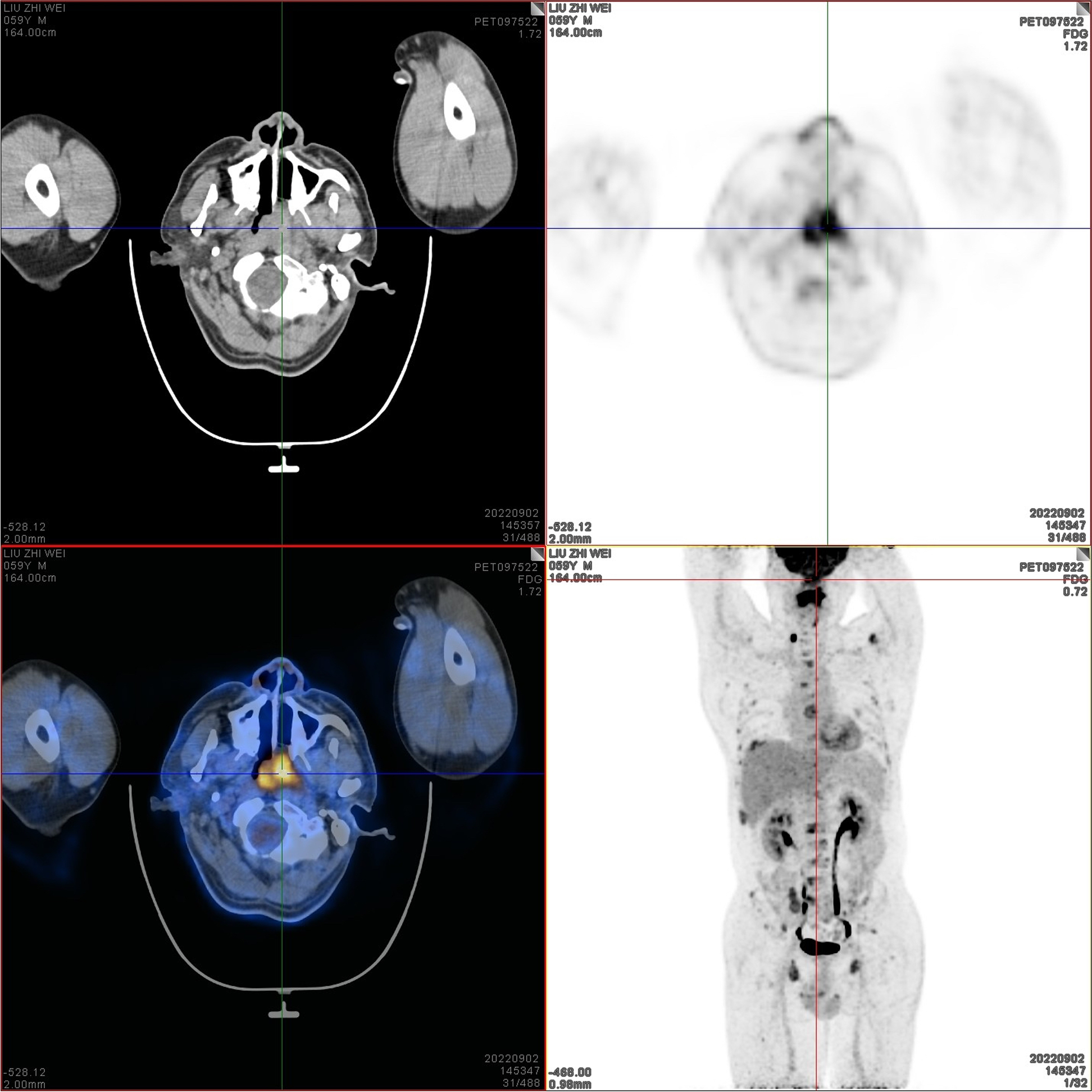 Fig. 1