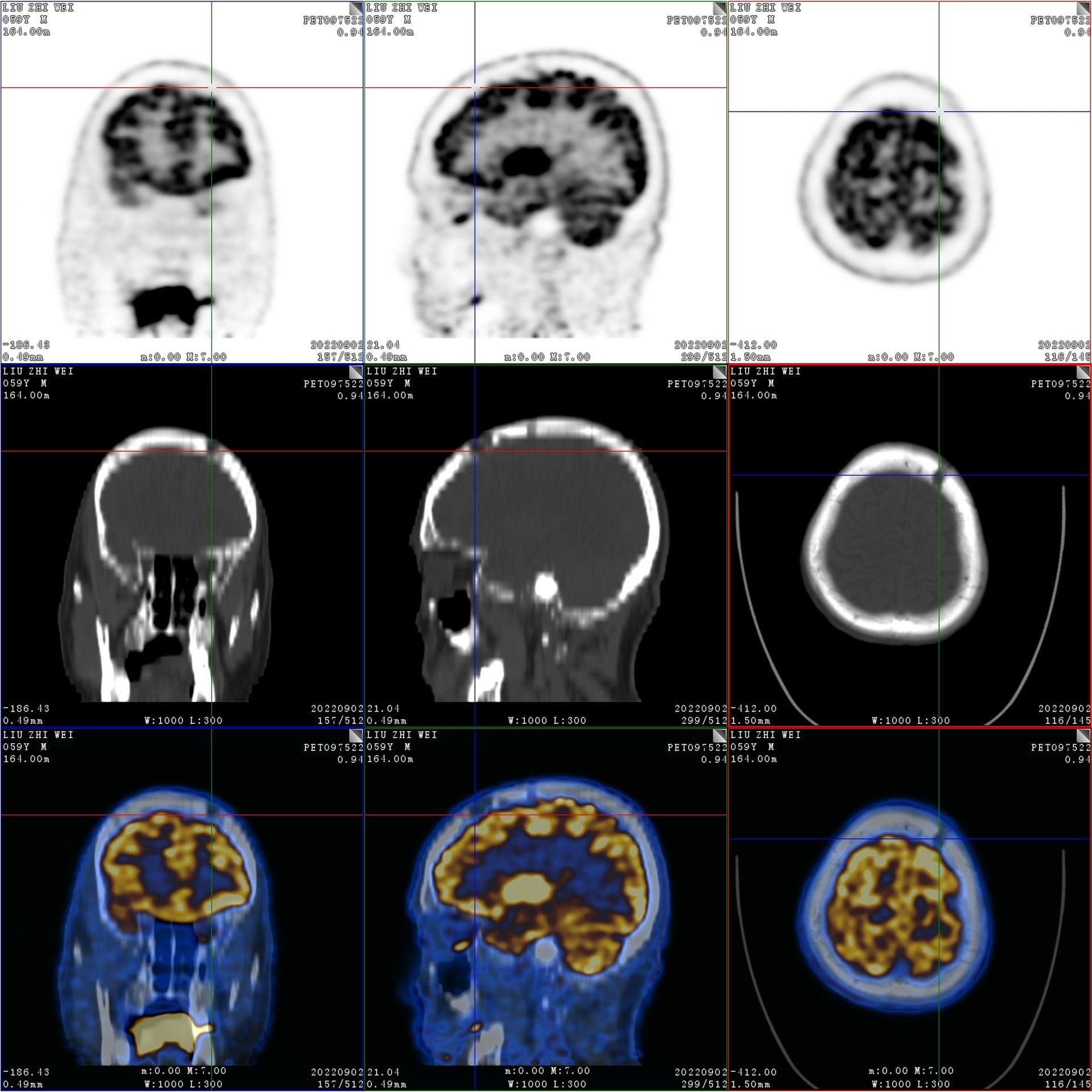 Fig. 6