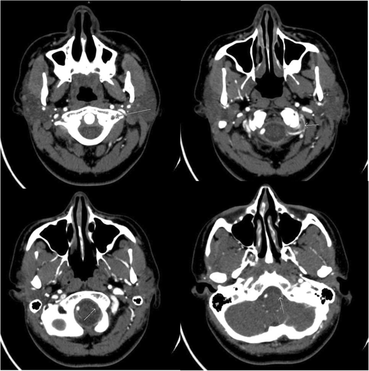 Fig. 3