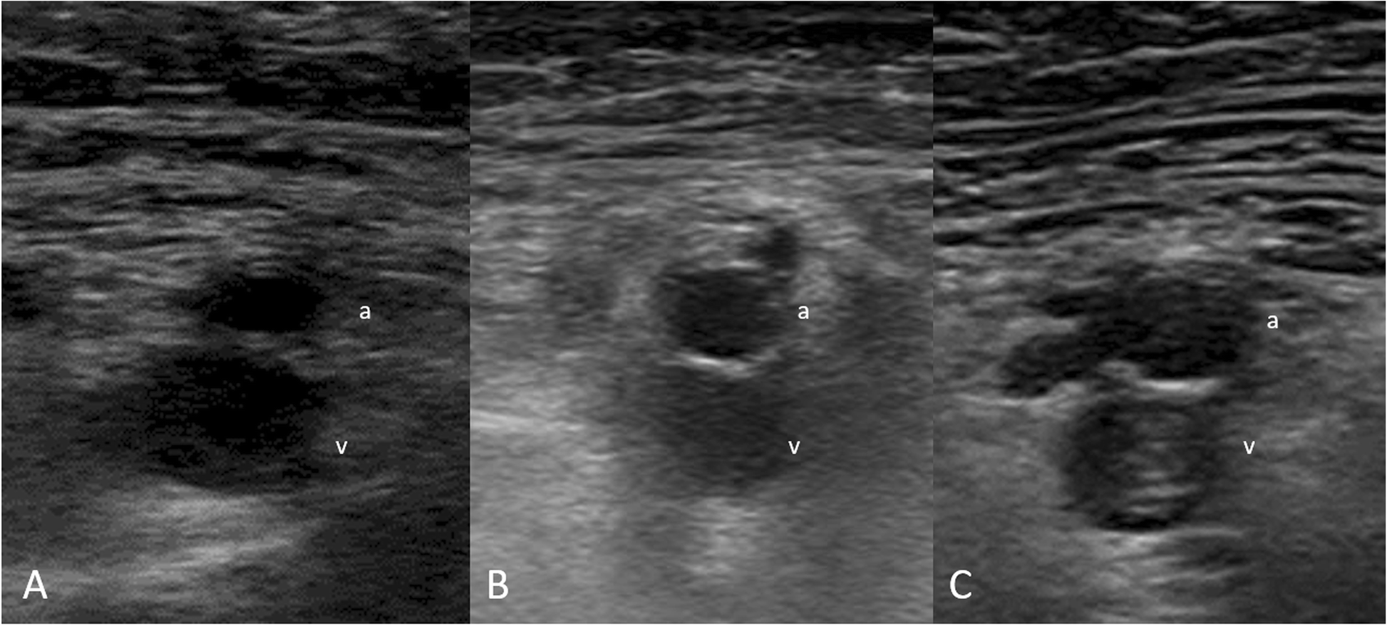 Fig. 2