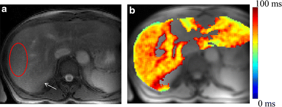 Fig. 4