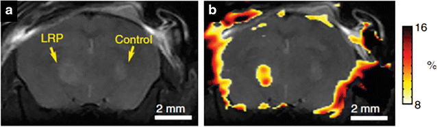 Fig. 15