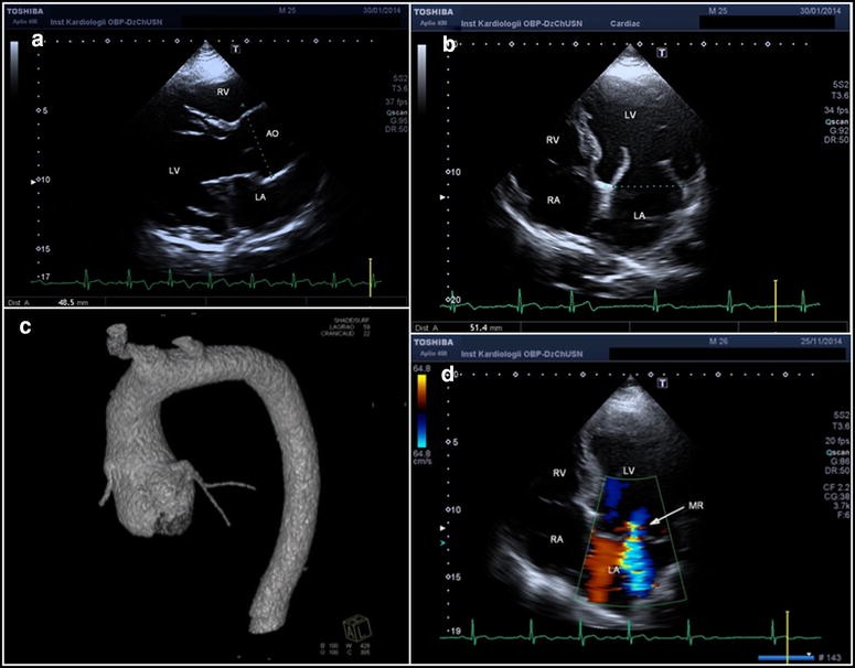 Fig. 4