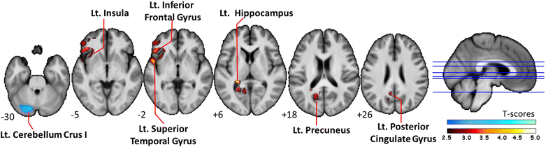 Fig. 2