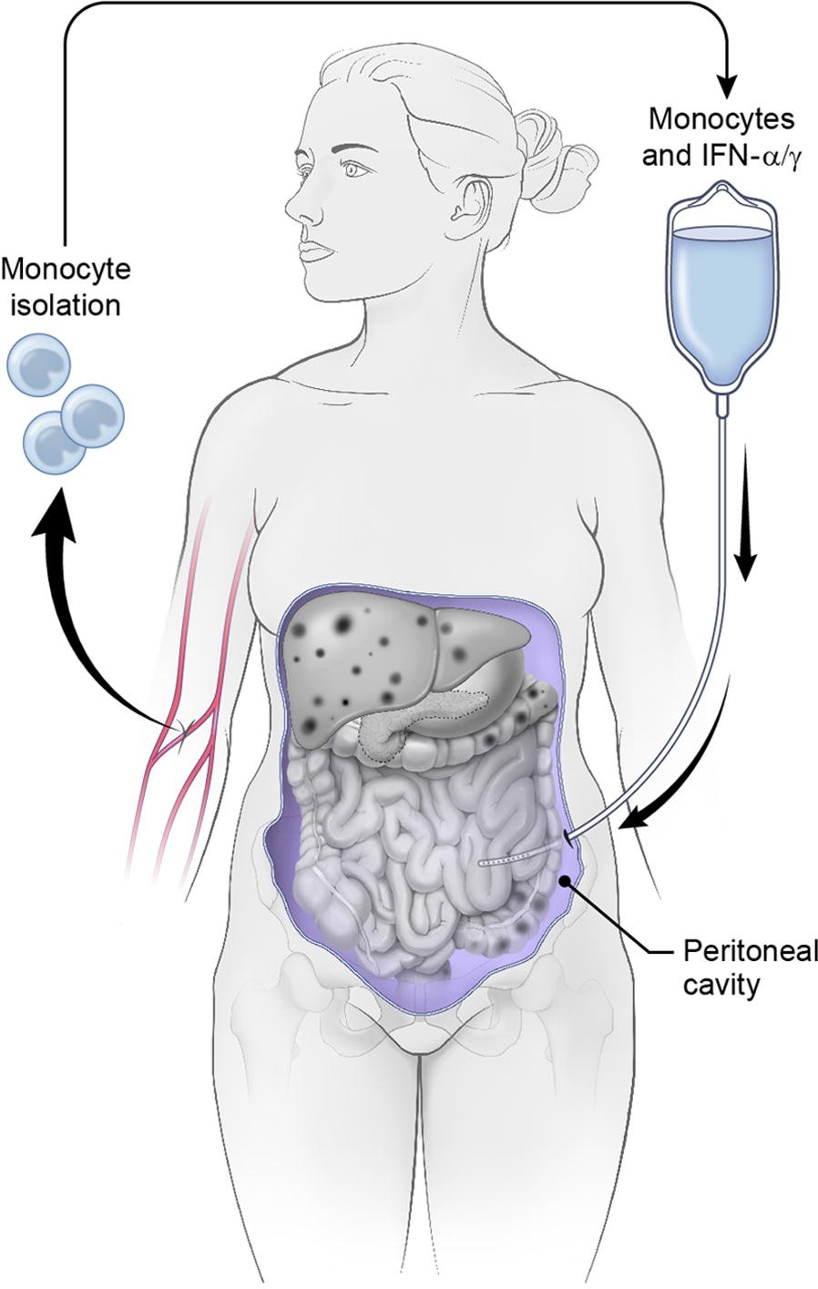 Fig. 1