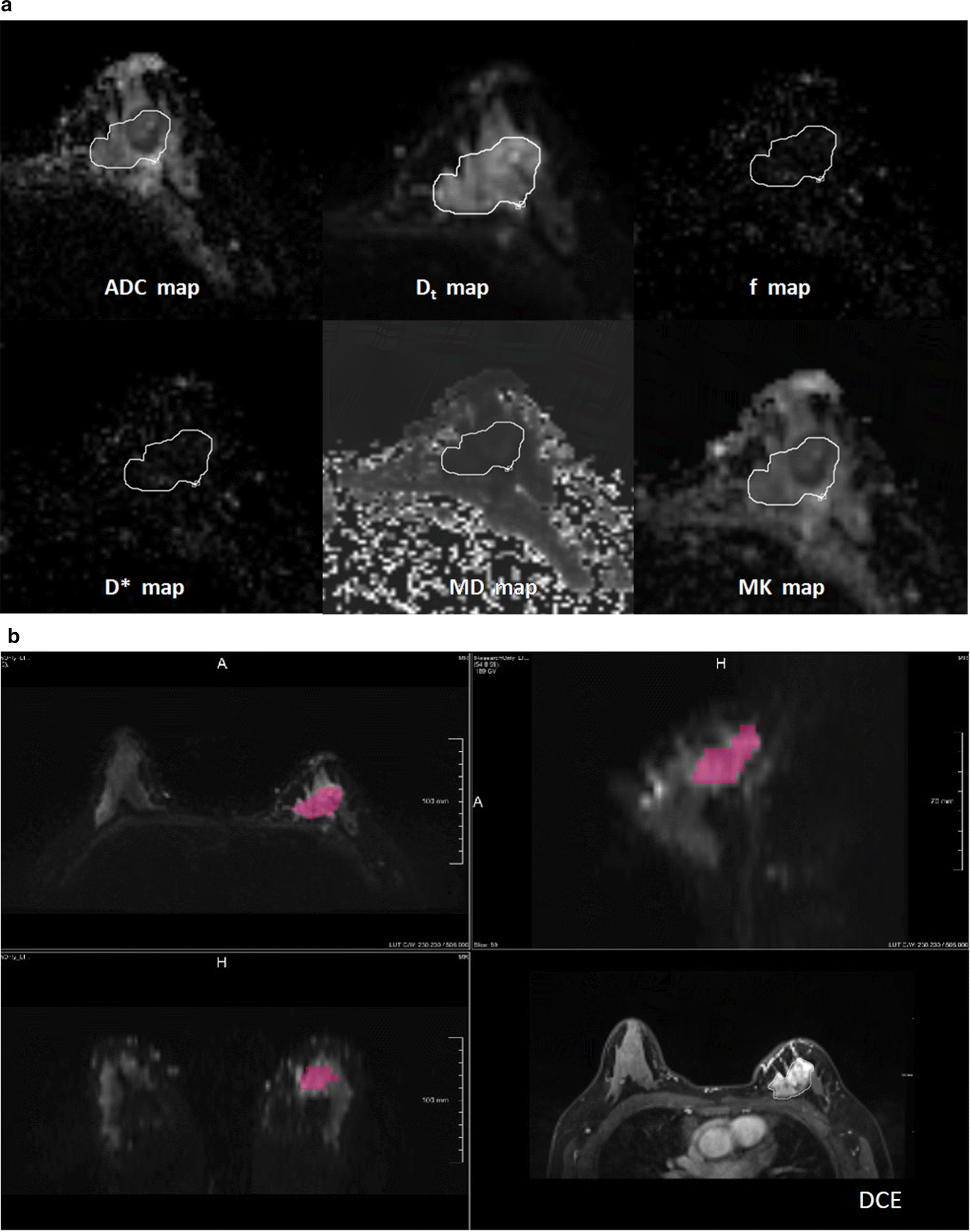 Fig. 1