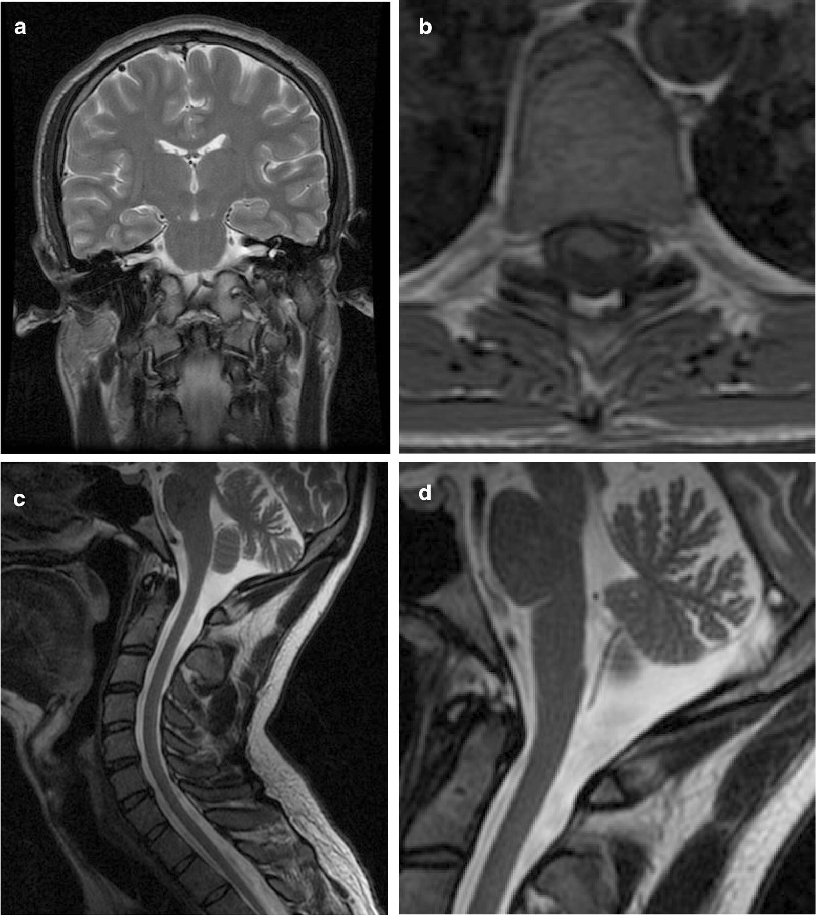 Fig. 2