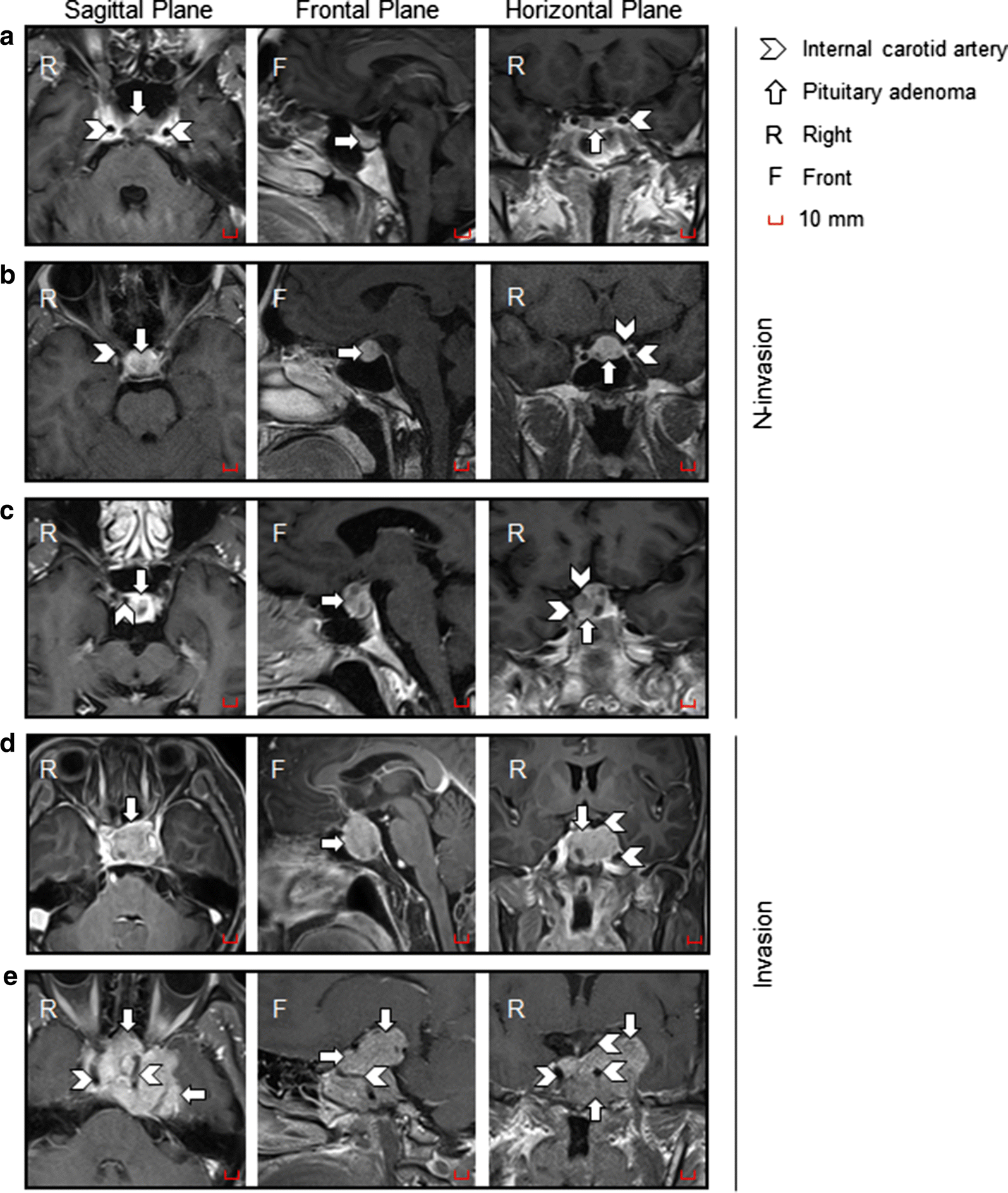 Fig. 1