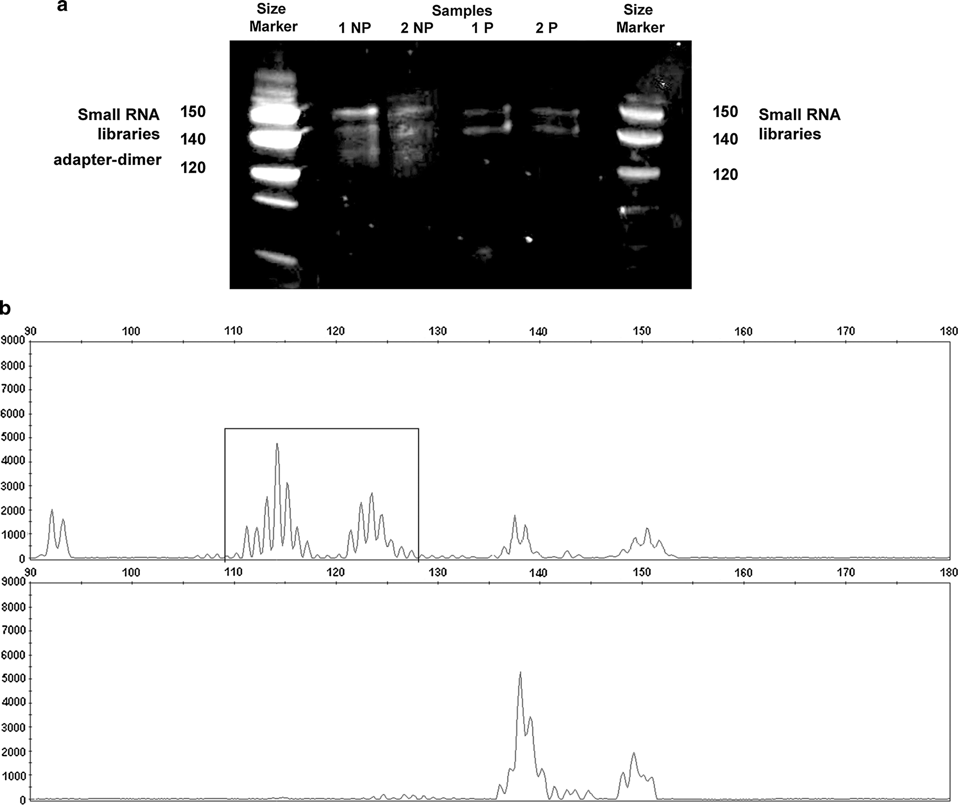 Optimization of small RNA library preparation protocol from human urinary  exosomes | Journal of Translational Medicine | Full Text