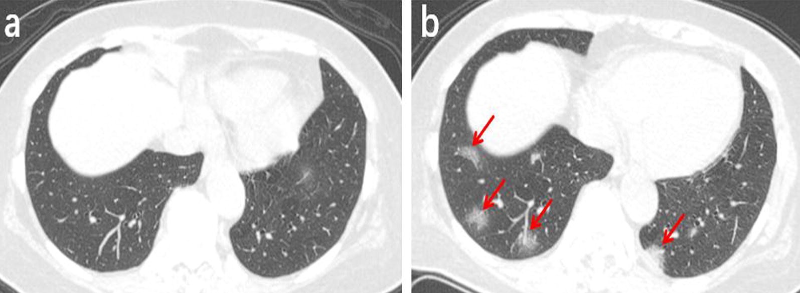 Fig. 5