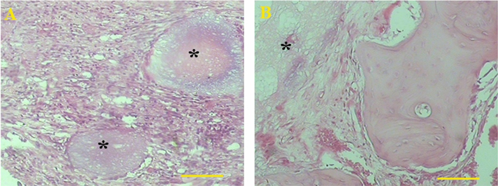 Fig. 13