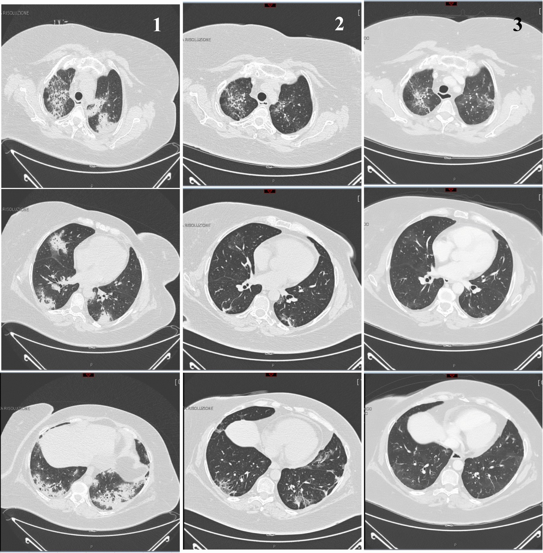 Fig. 1