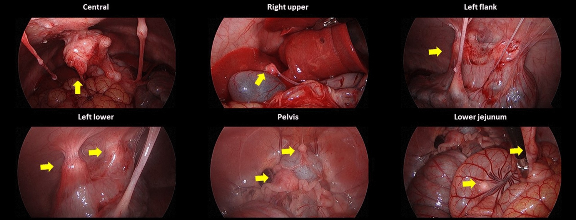 Fig. 12