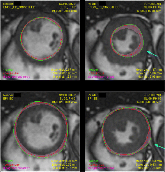 Fig. 4