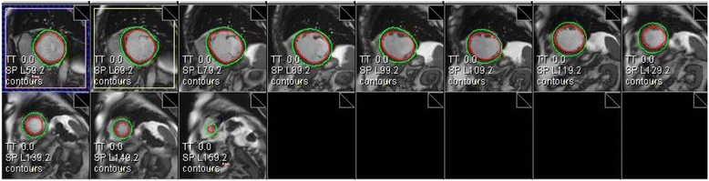 Fig. 9