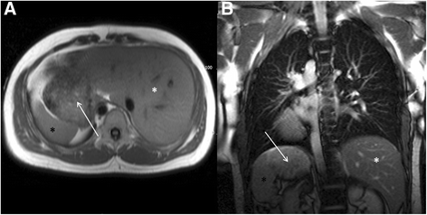 Fig. 12