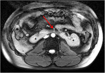 Fig. 15