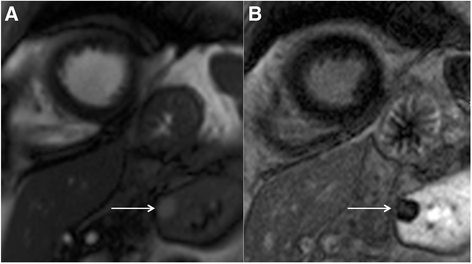 Fig. 17