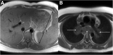 Fig. 18