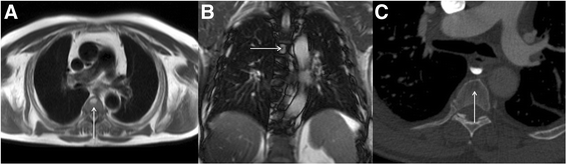 Fig. 25