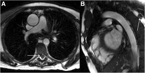 Fig. 26