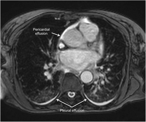 Fig. 12