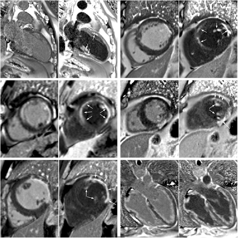 Fig. 6