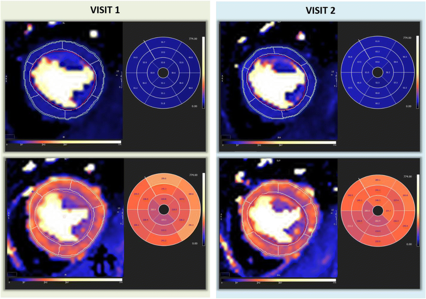 Fig. 2