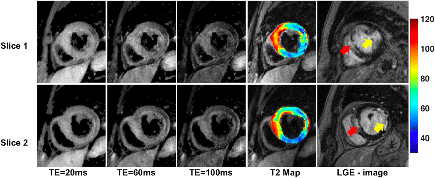 Fig. 9