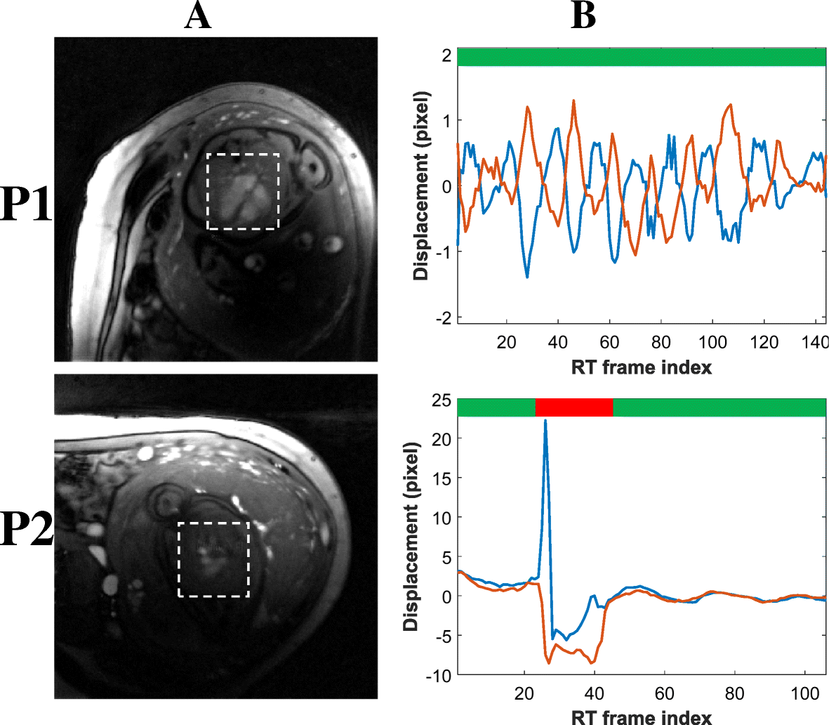 Fig. 5